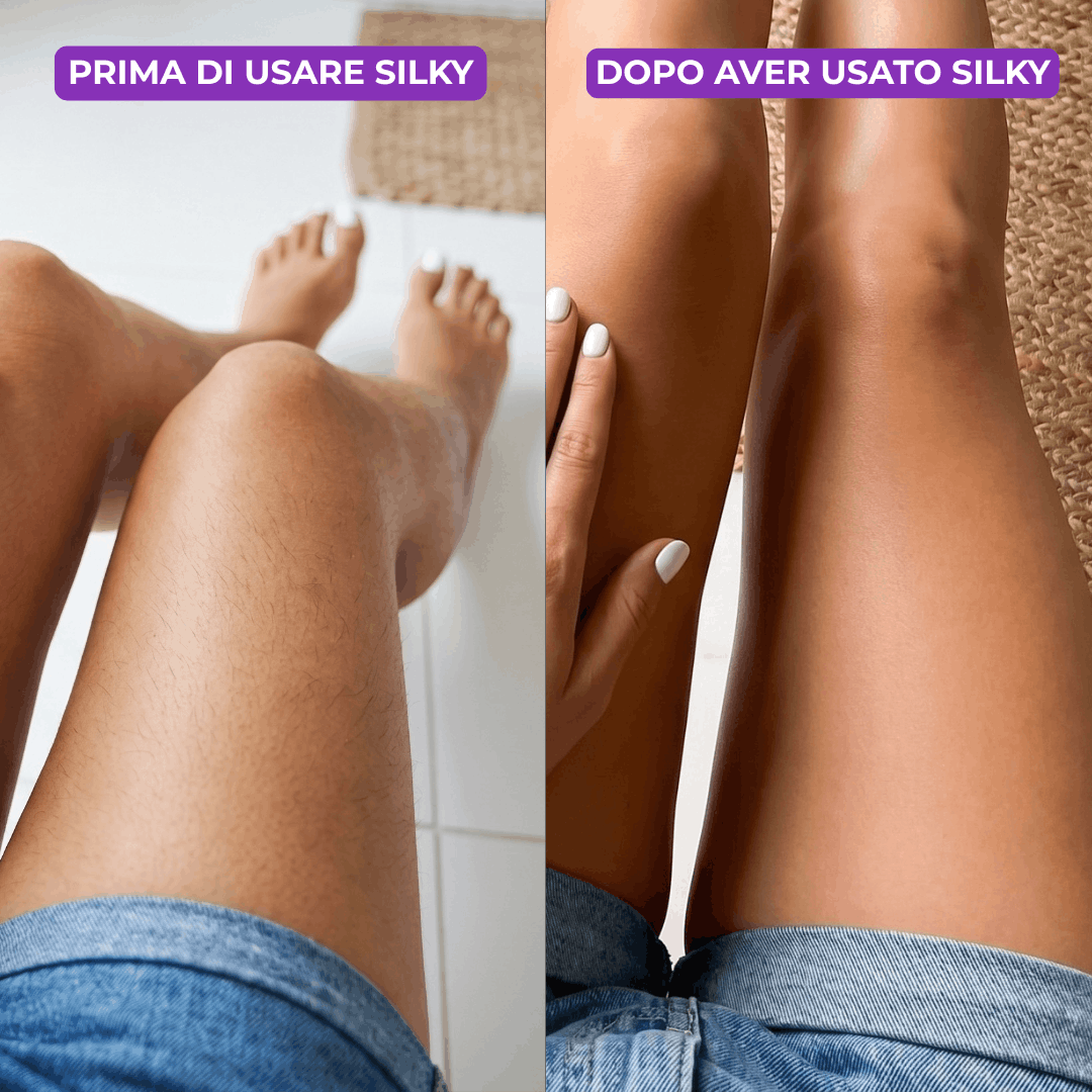 Silky | Epilatore Indolore
